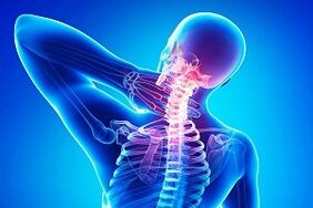 dolor de espalda como síntoma de osteocondrosis