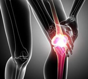 dolor de rodilla en artritis y artrosis