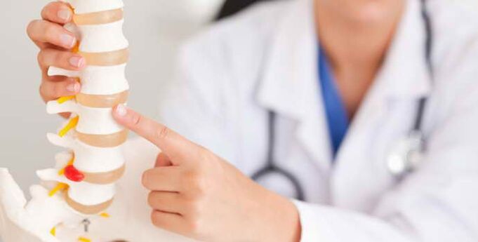 La osteocondrosis es una enfermedad de la columna