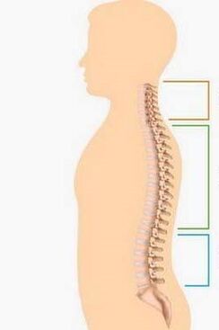 lesión de osteocondrosis de diferentes partes de la columna vertebral
